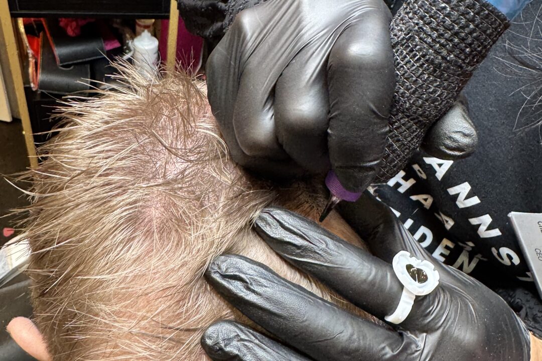 Sascha Mylenbusch Exklusiv Hair & Style - Kopfhautpigmentierung mit HeadSkin Coloring in Berlin und Düsseldorf
